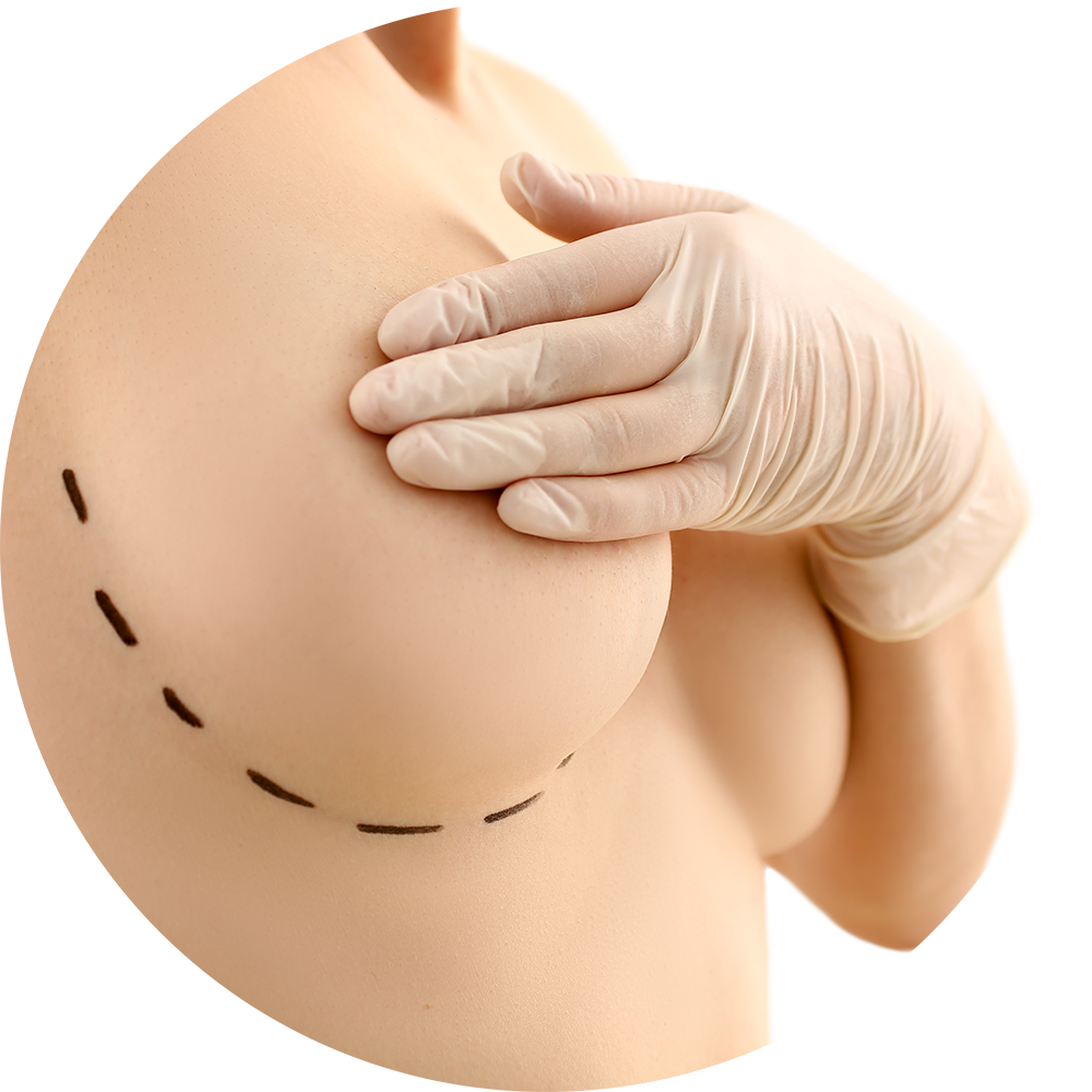 Levantamiento de los Senos o Pexia Mamaria Levantamiento de los Senos o Pexia Mamaria