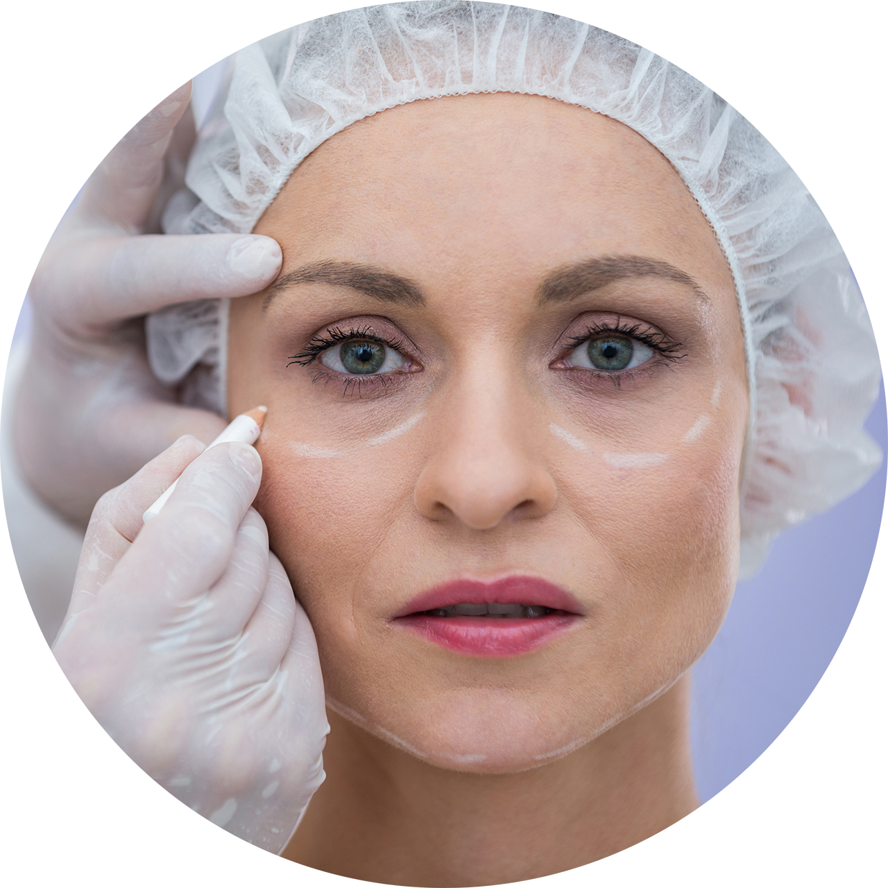 Cirugía de los Párpados o Blefaroplastia Cirugía de los Párpados o Blefaroplastia