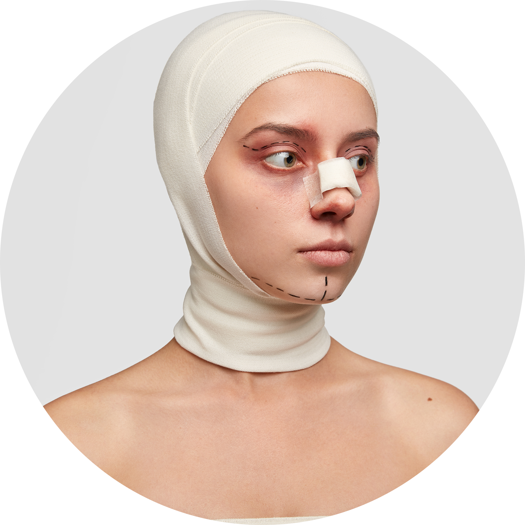 Cirugía Nasal o Rinoplastia, Estética y/o Funcional Cirugía Nasal o Rinoplastia, Estética y/o Funcional