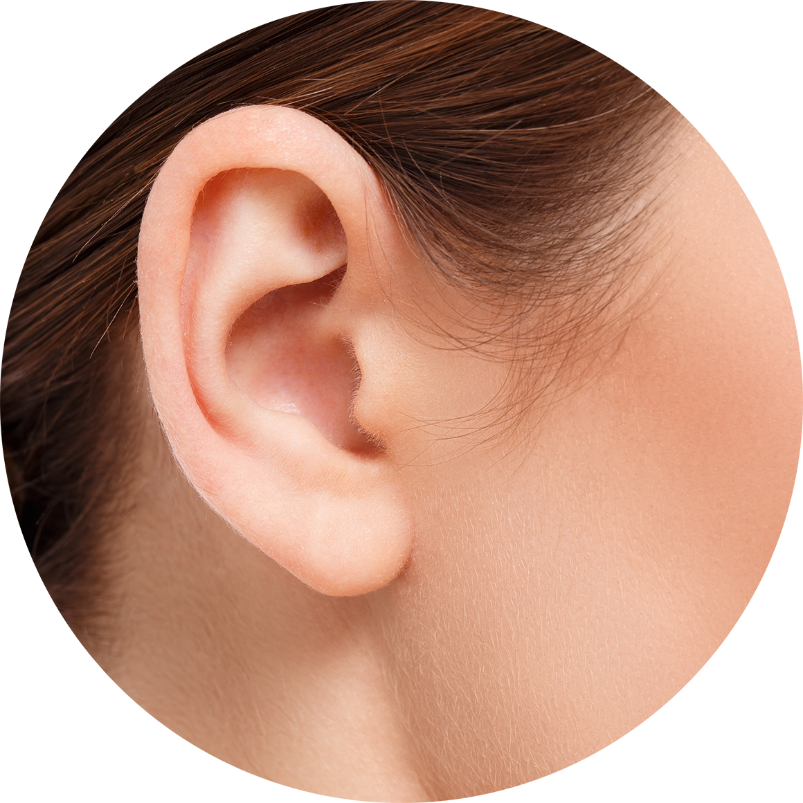 Cirugía de las Orejas Prominentes o de Ratón u Otoplastia Cirugía de las Orejas Prominentes o de Ratón u Otoplastia