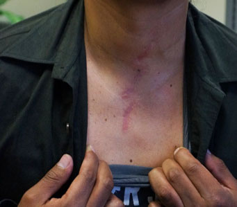 Cirugías Poco Invasivas