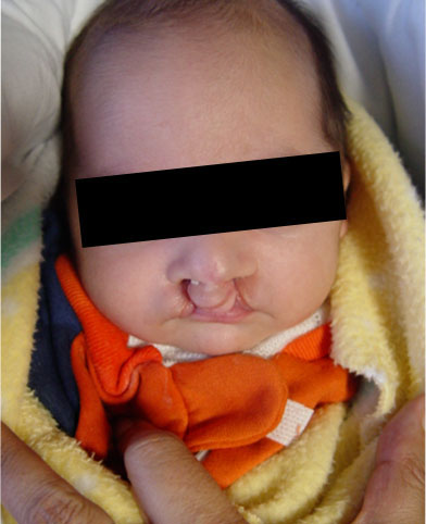 Cirugía Reconstructiva