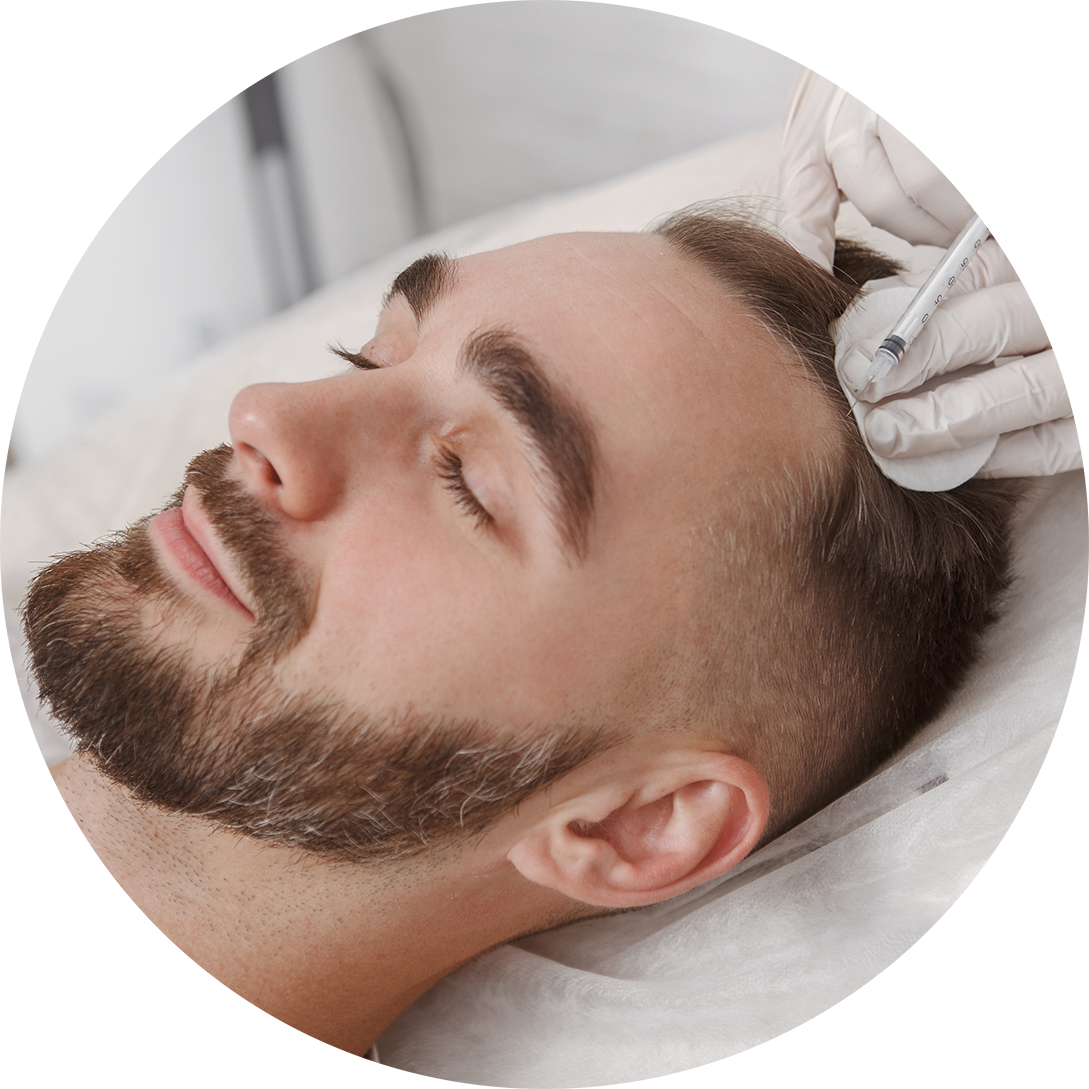 Cirugía de la calvicie, alopecias y trastornos de la piel cabelluda Cirugía de la calvicie, alopecias y trastornos de la piel cabelluda