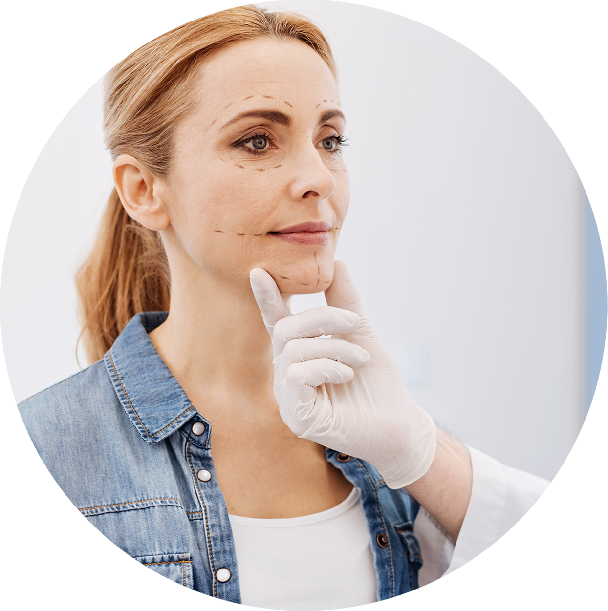 Mentoplastia o Aumento de mentón Mentoplastia o Aumento de mentón